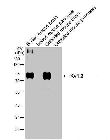 Boiled and unboiled mouse tissue extract (50 μg) were separated by 10% SDS-PAGE, and the membrane was blotted with Kv1.2 antibody [HL3163] (GTX640673) diluted at 1:1000. The HRP-conjugated anti-rabbit IgG antibody (GTX213110-01) was used to detect the primary antibody.
