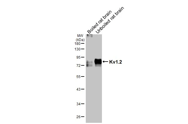 Boiled and unboiled rat tissue extract (50 μg) were separated by 10% SDS-PAGE, and the membrane was blotted with Kv1.2 antibody [HL3163] (GTX640673) diluted at 1:1000. The HRP-conjugated anti-rabbit IgG antibody (GTX213110-01) was used to detect the primary antibody.