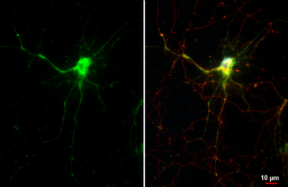 Maxi Potassium channel alpha antibody [HL3164] detects Maxi Potassium channel alpha protein by immunofluorescent analysis. Sample: DIV11 rat E18 primary hippocampal neuron cells were fixed in 4% paraformaldehyde at RT for 15 min. Green: Maxi Potassium channel alpha stained by Maxi Potassium channel alpha antibody [HL3164] (GTX640674) diluted at 1:250. Red: Tau, an axon marker, stained by Tau antibody [GT287] (GTX634809) diluted at 1:500. Blue: Fluoroshield with DAPI (GTX30920).