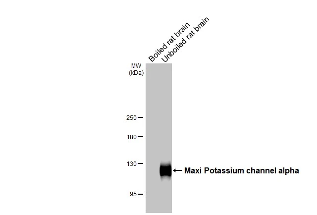 Boiled and unboiled rat tissue extracts (50 μg) were separated by 5% SDS-PAGE, and the membrane was blotted with Maxi Potassium channel alpha antibody [HL3164] (GTX640674) diluted at 1:1000. The HRP-conjugated anti-rabbit IgG antibody (GTX213110-01) was used to detect the primary antibody.