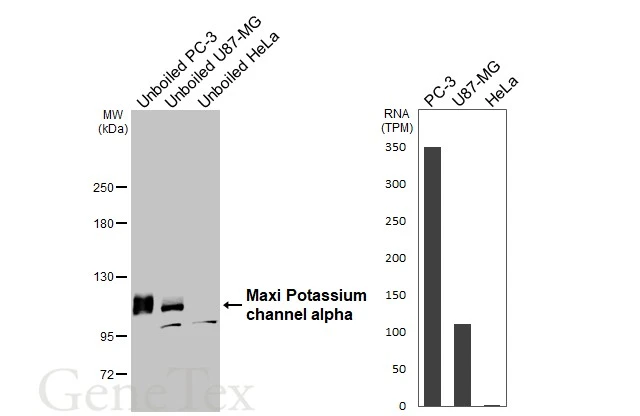 Unboiled various whole cell extracts (30 μg) were separated by 5% SDS-PAGE, and the membrane was blotted with Maxi Potassium channel alpha antibody [HL3164] (GTX640674) diluted at 1:1000. The HRP-conjugated anti-rabbit IgG antibody (GTX213110-01) was used to detect the primary antibody. Corresponding RNA expression data for the same cell lines are based on Human Protein Atlas program.