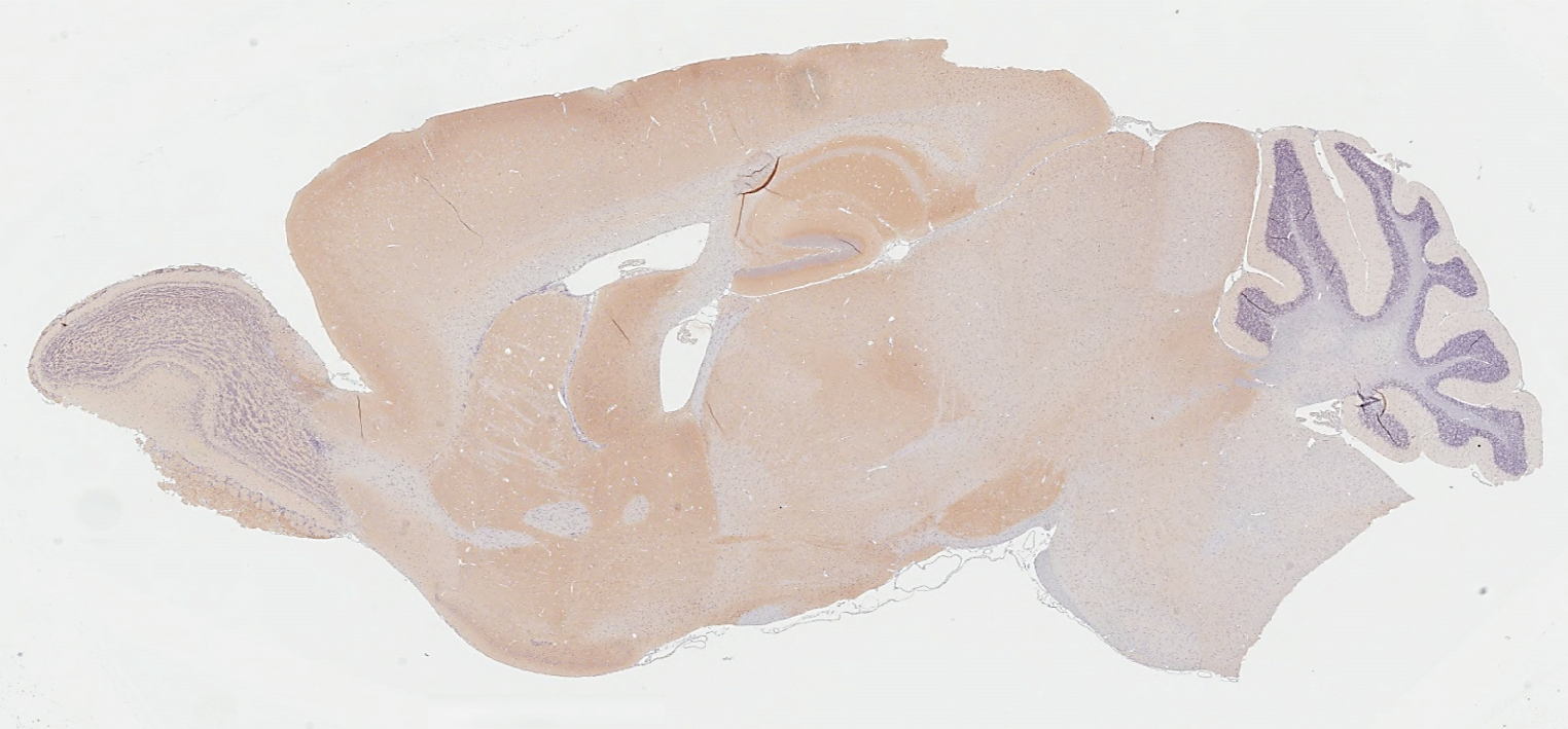 PSD95 antibody [HL3165] detects PSD95 protein by immunohistochemical analysis. Sample: Paraffin-embedded mouse brain. PSD95 stained by PSD95 antibody [HL3165] (GTX640675) diluted at 1:200. Antigen Retrieval: Citrate buffer, pH 6.0, 15 min