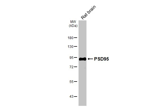 Rat tissue extract (50 μg) was separated by 7.5% SDS-PAGE, and the membrane was blotted with PSD95 antibody [HL3165] (GTX640675) diluted at 1:1000. The HRP-conjugated anti-rabbit IgG antibody (GTX213110-01) was used to detect the primary antibody.