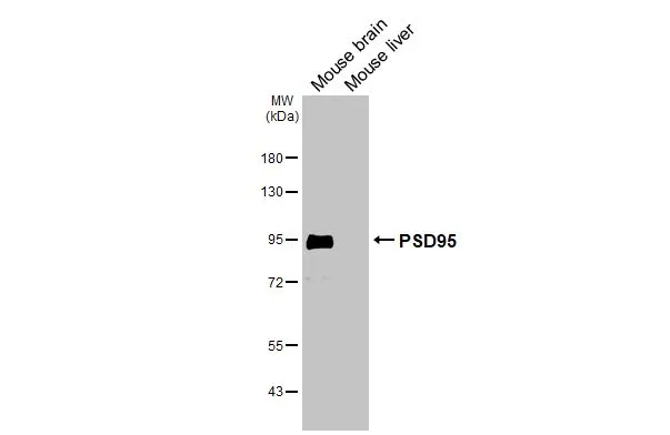 Various tissue extracts (50 μg) were separated by 7.5% SDS-PAGE, and the membrane was blotted with PSD95 antibody [HL3165] (GTX640675) diluted at 1:100000. The HRP-conjugated anti-rabbit IgG antibody (GTX213110-01) was used to detect the primary antibody.