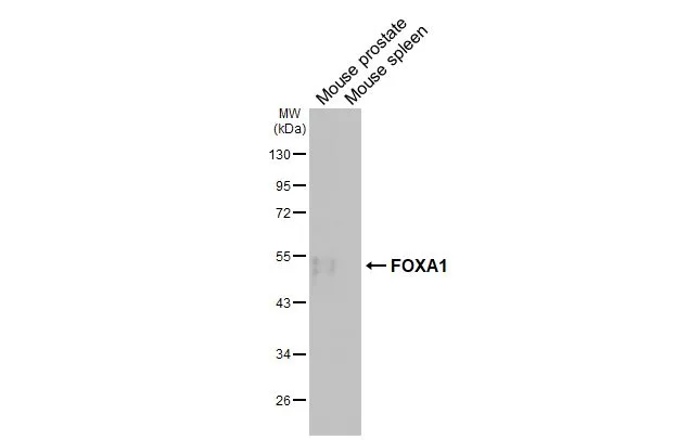 FOXA1 antibody [HL3168]