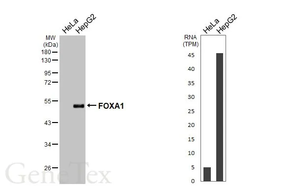 FOXA1 antibody [HL3168]