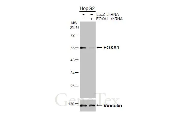 FOXA1 antibody [HL3168]
