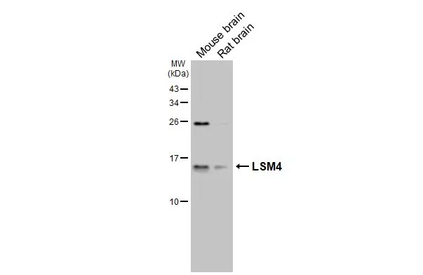 Various tissue extracts (50 μg) were separated by 15% SDS-PAGE, and the membrane was blotted with LSM4 antibody [HL3172] (GTX640690) diluted at 1:1000. The HRP-conjugated anti-rabbit IgG antibody (GTX213110-01) was used to detect the primary antibody, and the signal was developed with Trident ECL plus-Enhanced.