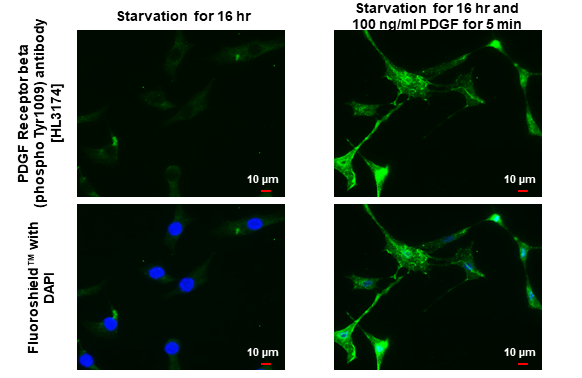 PDGF Receptor beta (phospho Tyr1009) antibody [HL3174] detects PDGF Receptor beta (phospho Tyr1009) protein by immunofluorescent analysis. Sample: Mock and treated NIH-3T3 cells were fixed in ice-cold MeOH for 5 min. Green: PDGF Receptor beta (phospho Tyr1009) stained by PDGF Receptor beta (phospho Tyr1009) antibody [HL3174] (GTX640692) diluted at 1:500. Blue: Fluoroshield with DAPI (GTX30920).