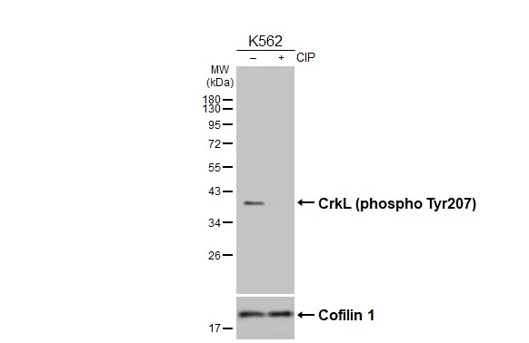 Untreated (–) and treated (+) K562 whole cell extracts (30 μg) were separated by 12% SDS-PAGE, and the membrane was blotted with CrkL (phospho Tyr207) antibody [HL3176] (GTX640694) diluted at 1:1000. The HRP-conjugated anti-rabbit IgG antibody (GTX213110-01) was used to detect the primary antibody.