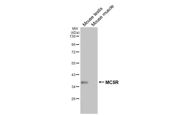 Various tissue extracts (50 μg) were separated by 10% SDS-PAGE, and the membrane was blotted with MC5R antibody [HL3178] (GTX640696) diluted at 1:1000. The HRP-conjugated anti-rabbit IgG antibody (GTX213110-01) was used to detect the primary antibody, and the signal was developed with Trident ECL plus-Enhanced.