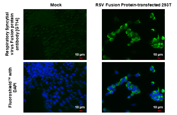 Respiratory Syncytial virus Fusion protein antibody [GT14] detects Respiratory Syncytial virus Fusion protein by immunofluorescent analysis. Sample: Mock and transfected 293T cells were fixed in 4% paraformaldehyde at RT for 15 min. Green: Respiratory Syncytial virus Fusion protein stained by Respiratory Syncytial virus Fusion protein antibody [GT14] (GTX640819) diluted at 1:500. Blue: Fluoroshield with DAPI (GTX30920).