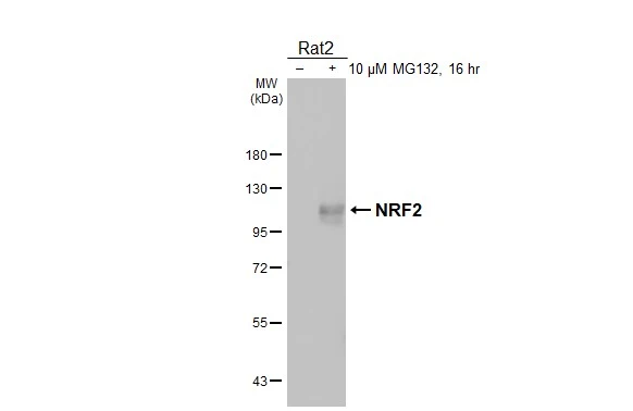 Untreated (–) and treated (+) Rat2 whole cell extracts (30 μg) were separated by 7.5% SDS-PAGE, and the membrane was blotted with NRF2 antibody [HL3183] (GTX640822) diluted at 1:1000. The HRP-conjugated anti-rabbit IgG antibody (GTX213110-01) was used to detect the primary antibody, and the signal was developed with Trident ECL plus-Enhanced.