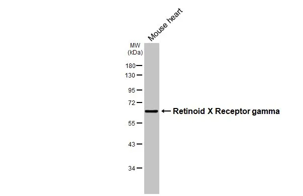 Mouse tissue extract (50 μg) was separated by 10% SDS-PAGE, and the membrane was blotted with Retinoid X Receptor gamma antibody [HL3185] (GTX640824) diluted at 1:1000. The HRP-conjugated anti-rabbit IgG antibody (GTX213110-01) was used to detect the primary antibody.