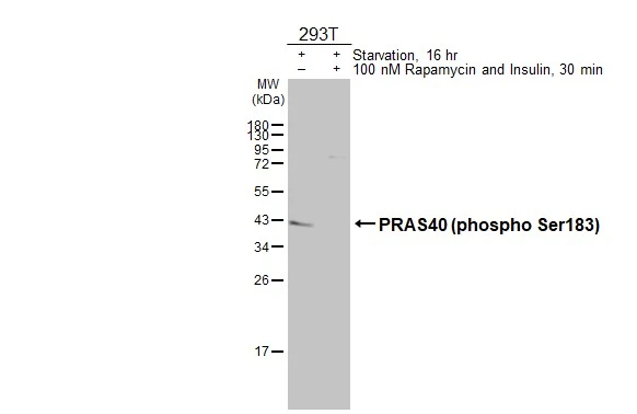 Untreated (–) and treated (+) 293T whole cell extracts (30 μg) were separated by 12% SDS-PAGE, and the membrane was blotted with PRAS40 (phospho Ser183) antibody [HL3189] (GTX640828) diluted at 1:1000. The HRP-conjugated anti-rabbit IgG antibody (GTX213110-01) was used to detect the primary antibody.