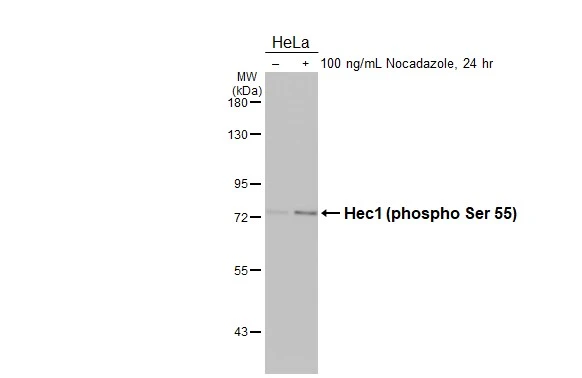 Untreated (–) and treated (+) HeLa whole cell extracts (30 μg) were separated by 7.5% SDS-PAGE, and the membrane was blotted with Hec1 (phospho Ser 55) antibody [HL3190] (GTX640829) diluted at 1:1000. The HRP-conjugated anti-rabbit IgG antibody (GTX213110-01) was used to detect the primary antibody.