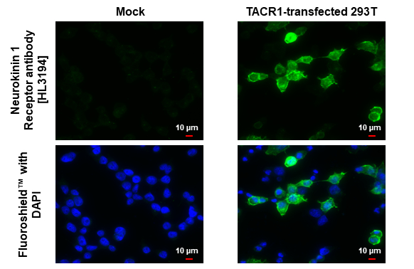 Neurokinin 1 Receptor antibody [HL3194] detects Neurokinin 1 Receptor protein by immunofluorescent analysis. Sample: Mock and transfected 293T cells were fixed in ice-cold MeOH for 5 min. Green: Neurokinin 1 Receptor stained by Neurokinin 1 Receptor antibody [HL3194] (GTX640833) diluted at 1:500. Blue: Fluoroshield with DAPI (GTX30920).