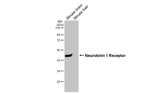 Various tissue extracts (50 μg) were separated by 10% SDS-PAGE, and the membrane was blotted with Neurokinin 1 Receptor antibody [HL3195] (GTX640834) diluted at 1:1000. The HRP-conjugated anti-rabbit IgG antibody (GTX213110-01) was used to detect the primary antibody.
