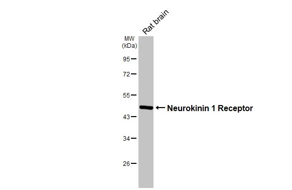 Rat tissue extract (50 μg) was separated by 10% SDS-PAGE, and the membrane was blotted with Neurokinin 1 Receptor antibody [HL3195] (GTX640834) diluted at 1:1000. The HRP-conjugated anti-rabbit IgG antibody (GTX213110-01) was used to detect the primary antibody.