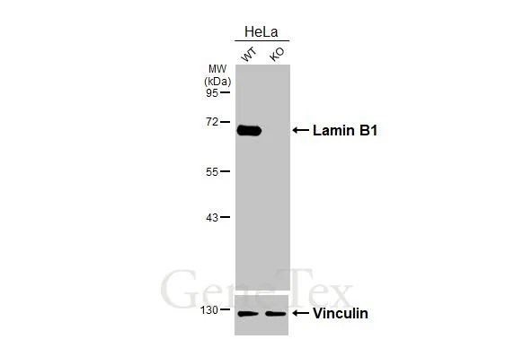 Wild-type (WT) and Lamin B1 knockout (KO) HeLa cell extracts (30 μg) were separated by 7.5% SDS-PAGE, and the membrane was blotted with Lamin B1 antibody [HL3224] (GTX640865) diluted at 1:1000. The HRP-conjugated anti-rabbit IgG antibody (GTX213110-01) was used to detect the primary antibody.