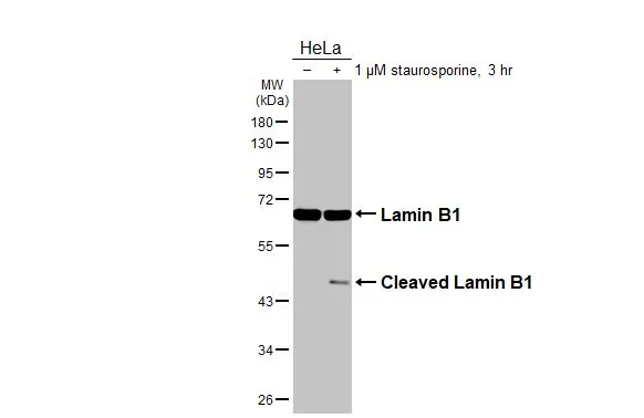 Untreated (–) and treated (+) HeLa whole cell extracts (30 μg) were separated by 10% SDS-PAGE, and the membrane was blotted with Lamin B1 antibody [HL3224] (GTX640865) diluted at 1:20000. The HRP-conjugated anti-rabbit IgG antibody (GTX213110-01) was used to detect the primary antibody.