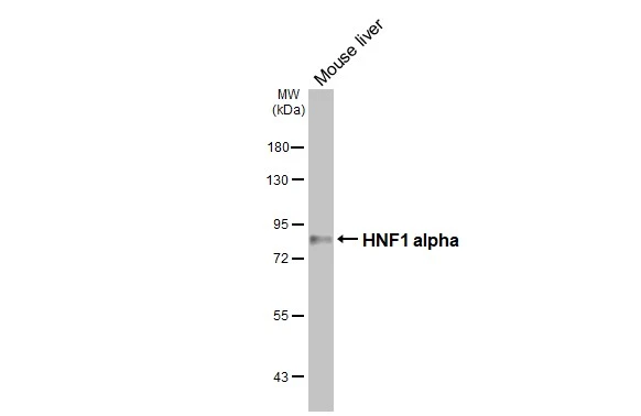 Mouse tissue extract (50 μg) was separated by 7.5% SDS-PAGE, and the membrane was blotted with HNF1 alpha antibody [HL3229] (GTX640870) diluted at 1:1000. The HRP-conjugated anti-rabbit IgG antibody (GTX213110-01) was used to detect the primary antibody.
