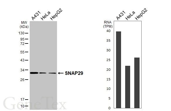Various whole cell extracts (30 μg) were separated by 12% SDS-PAGE, and the membrane was blotted with SNAP29 antibody [HL3232] (GTX640873) diluted at 1:1000. The HRP-conjugated anti-rabbit IgG antibody (GTX213110-01) was used to detect the primary antibody. Corresponding RNA expression data for the same cell lines are based on Human Protein Atlas program.