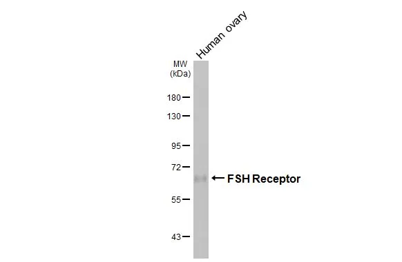 FSH Receptor antibody [HL3233]