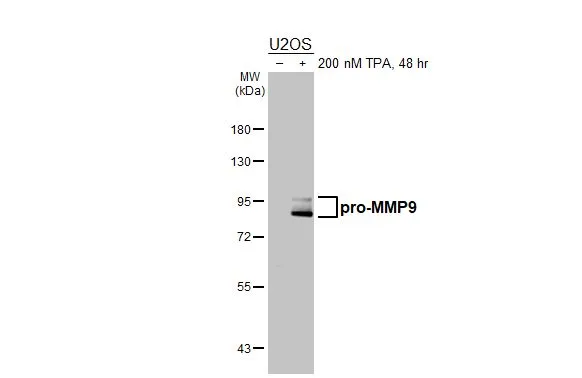 Untreated (–) and treated (+) U2OS whole cell extracts (30 μg) were separated by 7.5% SDS-PAGE, and the membrane was blotted with MMP9 antibody [HL3239] (GTX640882) diluted at 1:1000. The HRP-conjugated anti-rabbit IgG antibody (GTX213110-01) was used to detect the primary antibody.