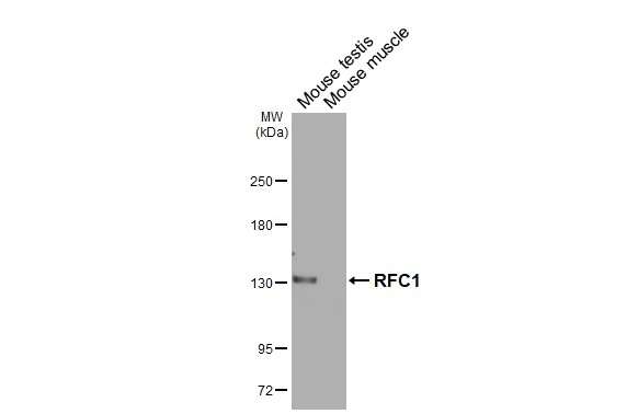 Various tissue extracts (50 μg) were separated by 5% SDS-PAGE, and the membrane was blotted with RFC1 antibody [HL3242] (GTX640885) diluted at 1:1000. The HRP-conjugated anti-rabbit IgG antibody (GTX213110-01) was used to detect the primary antibody.