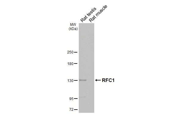 Various tissue extracts (50 μg) were separated by 5% SDS-PAGE, and the membrane was blotted with RFC1 antibody [HL3242] (GTX640885) diluted at 1:1000. The HRP-conjugated anti-rabbit IgG antibody (GTX213110-01) was used to detect the primary antibody.