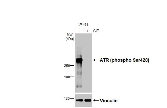 Untreated (–) and treated (+) 293T whole cell extracts (30 μg) were separated by 5% SDS-PAGE, and the membrane was blotted with ATR (phospho Ser428) antibody [HL3246] (GTX640889) diluted at 1:1000. The HRP-conjugated anti-rabbit IgG antibody (GTX213110-01) was used to detect the primary antibody.