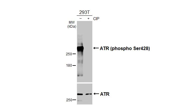 Untreated (–) and treated (+) 293T whole cell extracts (30 μg) were separated by 5% SDS-PAGE, and the membranes were blotted with ATR (phospho Ser428) antibody [HL3246] (GTX640889) diluted at 1:1000 and ATR antibody (GTX70109) diluted at 1:500. The HRP-conjugated anti-rabbit IgG antibody (GTX213110-01) was used to detect the primary antibody.