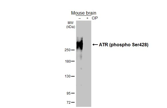 Untreated (–) and treated (+) mouse tissue extract (50 μg) were separated by 5% SDS-PAGE, and the membrane was blotted with ATR (phospho Ser428) antibody [HL3246] (GTX640889) diluted at 1:2500. The HRP-conjugated anti-rabbit IgG antibody (GTX213110-01) was used to detect the primary antibody.