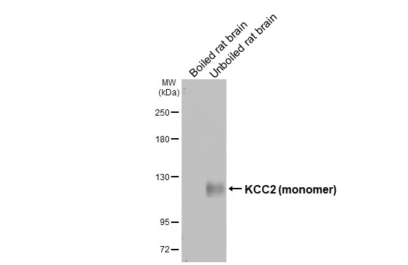 KCC2 antibody [GT16]