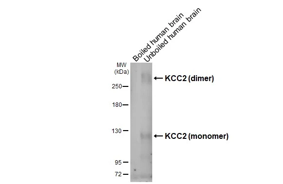 KCC2 antibody [GT16]