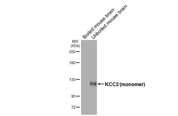 KCC2 antibody [GT16]
