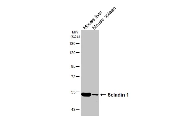 Various tissue extracts (50 μg) were separated by 7.5% SDS-PAGE, and the membrane was blotted with Seladin 1 antibody [HL3253] (GTX640900) diluted at 1:1000. The HRP-conjugated anti-rabbit IgG antibody (GTX213110-01) was used to detect the primary antibody.