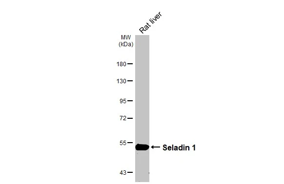 Rat tissue extract (50 μg) was separated by 7.5% SDS-PAGE, and the membrane was blotted with Seladin 1 antibody [HL3253] (GTX640900) diluted at 1:1000. The HRP-conjugated anti-rabbit IgG antibody (GTX213110-01) was used to detect the primary antibody.