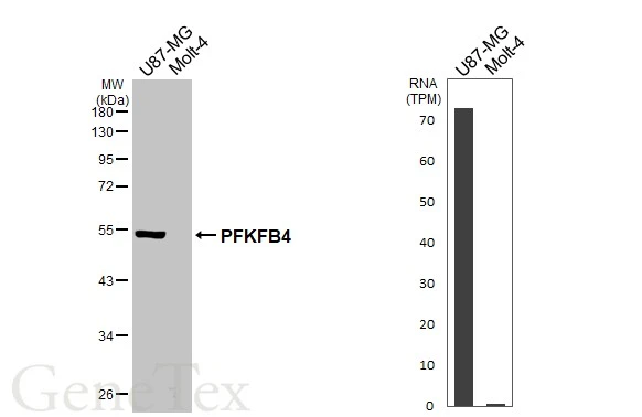 Various whole cell extracts (30 μg) were separated by 10% SDS-PAGE, and the membrane was blotted with PFKFB4 antibody [HL3254] (GTX640901) diluted at 1:1000. The HRP-conjugated anti-rabbit IgG antibody (GTX213110-01) was used to detect the primary antibody. Corresponding RNA expression data for the same cell lines are based on Human Protein Atlas program.