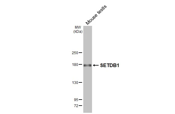 Mouse tissue extract (50 μg) was separated by 5% SDS-PAGE, and the membrane was blotted with SETDB1 antibody [HL3259] (GTX640906) diluted at 1:1000. The HRP-conjugated anti-rabbit IgG antibody (GTX213110-01) was used to detect the primary antibody.