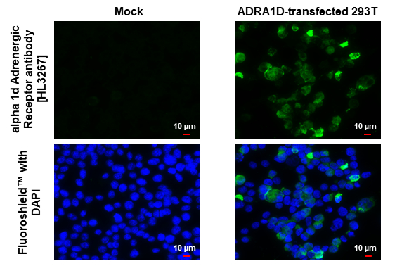 alpha 1d Adrenergic Receptor antibody [HL3267] detects alpha 1d Adrenergic Receptor protein by immunofluorescent analysis. Sample: Mock and transfected 293T cells were fixed in ice-cold MeOH for 5 min. Green: alpha 1d Adrenergic Receptor stained by alpha 1d Adrenergic Receptor antibody [HL3267] (GTX640914) diluted at 1:500. Blue: Fluoroshield with DAPI (GTX30920).