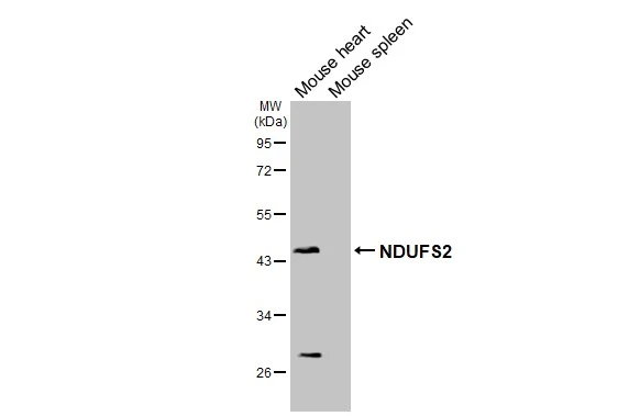 Various tissue extracts (50 μg) were separated by 10% SDS-PAGE, and the membrane was blotted with NDUFS2 antibody [HL3269] (GTX640923) diluted at 1:1000. The HRP-conjugated anti-rabbit IgG antibody (GTX213110-01) was used to detect the primary antibody.