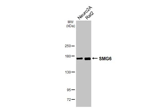 Various whole cell extracts (30 μg) were separated by 5% SDS-PAGE, and the membrane was blotted with SMG6 antibody [HL3274] (GTX640928) diluted at 1:1000. The HRP-conjugated anti-rabbit IgG antibody (GTX213110-01) was used to detect the primary antibody.