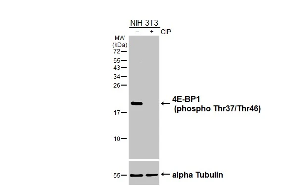 Untreated (–) and treated (+) NIH-3T3 whole cell extract (30 μg) were separated by 15% SDS-PAGE, and the membrane was blotted with 4E-BP1 (phospho Thr37/Thr46) antibody [HL3276] (GTX640930) diluted at 1:5000. The HRP-conjugated anti-rabbit IgG antibody (GTX213110-01) was used to detect the primary antibody.