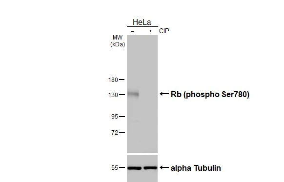 Untreated (–) and treated (+) HeLa whole cell extracts (30 μg) were separated by 7.5% SDS-PAGE, and the membrane was blotted with Rb (phospho Ser780) antibody [HL3285] (GTX640939) diluted at 1:1000. The HRP-conjugated anti-rabbit IgG antibody (GTX213110-01) was used to detect the primary antibody.
