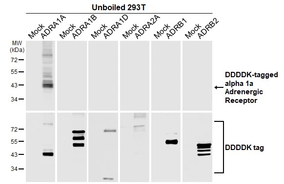 Unboiled non-transfected (–) and transfected (+) 293T whole cell extracts (30 μg) were separated by 10% SDS-PAGE, and the membrane was blotted with alpha 1a Adrenergic Receptor antibody [HL3291] (GTX640945) diluted at 1:5000. The HRP-conjugated anti-rabbit IgG antibody (GTX213110-01) was used to detect the primary antibody.