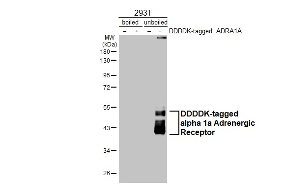 Non-transfected (–) and transfected (+) boiled and unboiled 293T whole cell extracts (30 μg) were separated by 10% SDS-PAGE, and the membrane was blotted with alpha 1a Adrenergic Receptor antibody [HL3291] (GTX640945) diluted at 1:5000. The HRP-conjugated anti-rabbit IgG antibody (GTX213110-01) was used to detect the primary antibody.