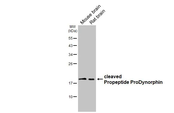 Various tissue extracts (50 μg) were separated by 12% SDS-PAGE, and the membrane was blotted with ProDynorphin antibody [HL3295] (GTX640984) diluted at 1:1000. The HRP-conjugated anti-rabbit IgG antibody (GTX213110-01) was used to detect the primary antibody.