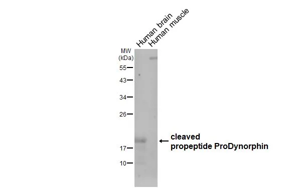 ProDynorphin antibody [HL3295]